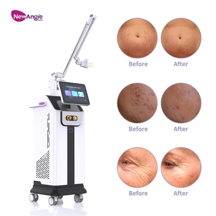 Dermatology Co2 Laser Machine
